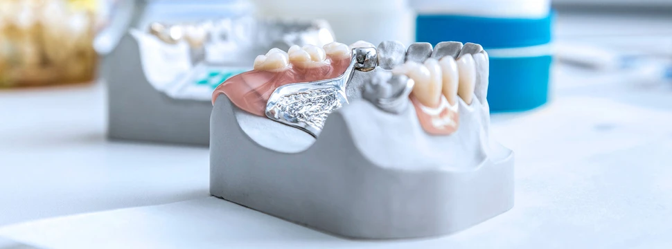 Zahnimplantate mit CAD / CAM Fertigung