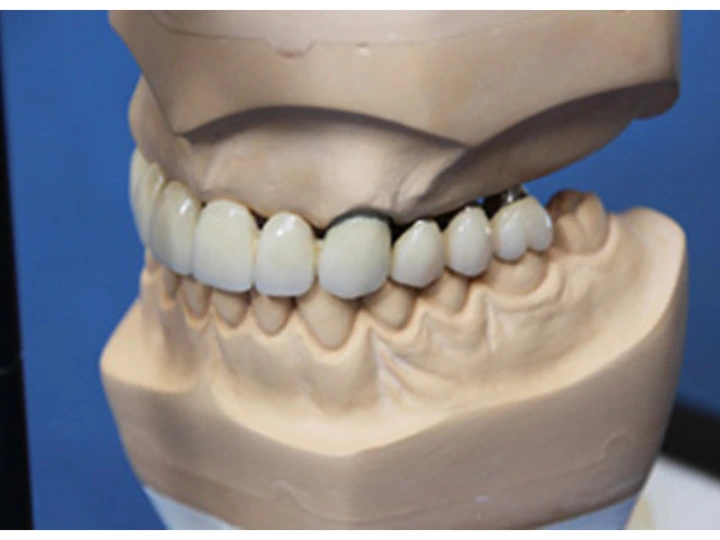 Galerie-Bild 1: Jasper Dental-Labor GmbH aus B&uuml;delsdorf von Jasper Dental-Labor GmbH 