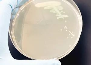 Kolonien von Pseudomonas aeruginosa-Bakterien auf einer Agarplatte ausgestrichen, © Dr. Antonia Habich