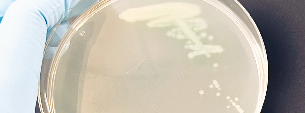 Kolonien von Pseudomonas aeruginosa-Bakterien auf einer Agarplatte ausgestrichen, © Dr. Antonia Habich